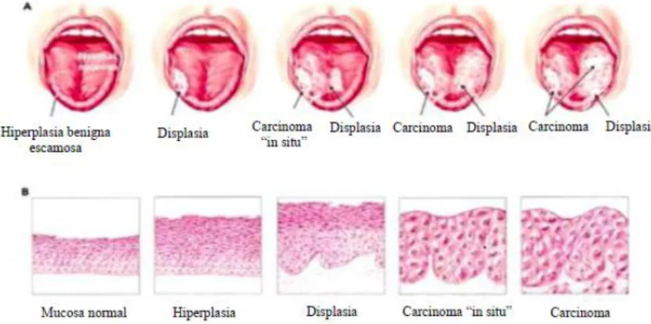 Tratamiento Cernimiento diagnóstico y tratamiento de cáncer de