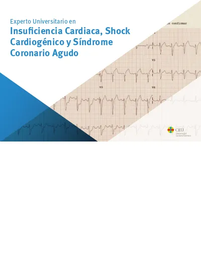 Experto Universitario En Insuficiencia Cardiaca Shock Cardiog Nico Y