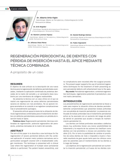 REGENERACIÓN PERIODONTAL DE DIENTES CON PÉRDIDA DE INSERCIÓN HASTA EL