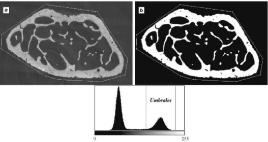 Figura 4.4: Ejemplo de segmentación binaria en huesos: (a) imagen original en escala de grises, (b) imagen binarizada