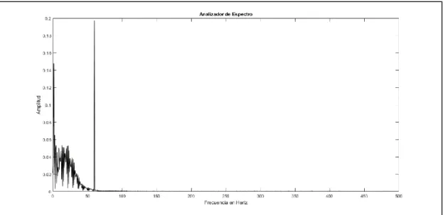 Figura N° 19. Transformada de Fourier para la señal de ECG con ruido de 60 Hz. 