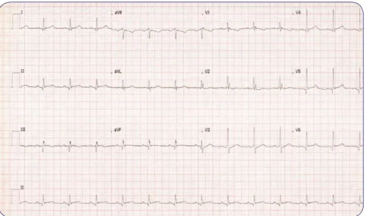 Figura 7. ECG Acceda a los vídeos