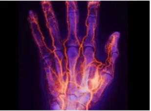Figura  4. Biometría Vascular Dedo y de la Mano 