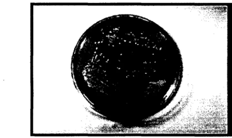 Figura 10:  Staphylococcus aureus  (Richardson, et al., 2008). 