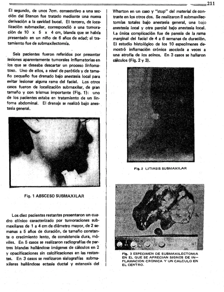 Fig.  1  ABSCESO  S U B M A X ILA R