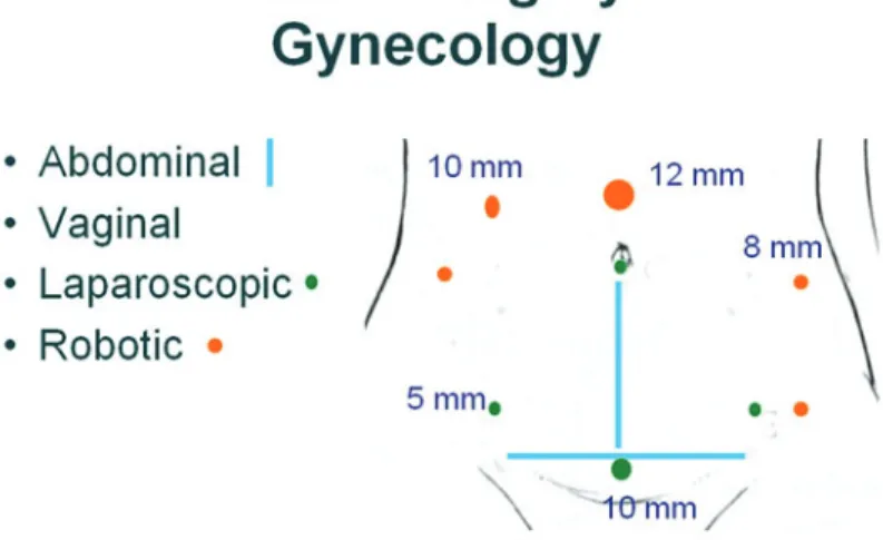 FIGURE 2  Surgical options in gynecology. Robotic surgery requires more and larger  incisions (red dots) compared to laparoscopic surgery (green) dots