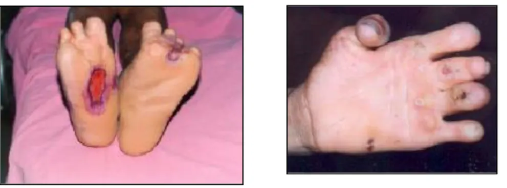 Figura 3.8.    Figura 3.9. 