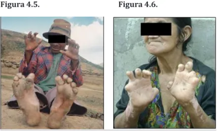 Figura 4.5.    Figura 4.6. 