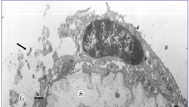 Fig. 6.- A syncytiotrophoblastic zone has been detached from the syncytiotrophoblast (arrow)