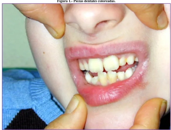 Figura 1.- Piezas dentales coloreadas. 