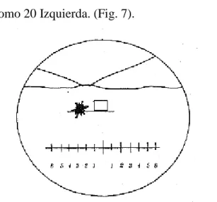 Fig. 7. Observación en Dirección, 20 Izquierda 