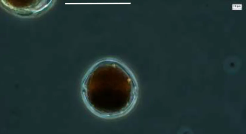 Figura 6. Célula de Alexandrium margalefii. Micrografía tomada por la Dra. Lourdes Morquecho  (CODIMAR)