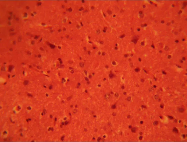 FIGURE 1: Control section of the inferior colliculus. (Original magnification x 400)