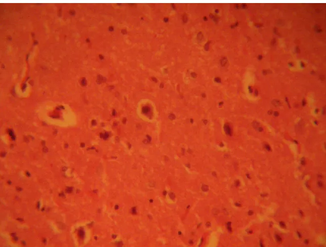FIGURE 3: Treatment section of the inferior colliculus (6g MSG) (Original magnification x 400)