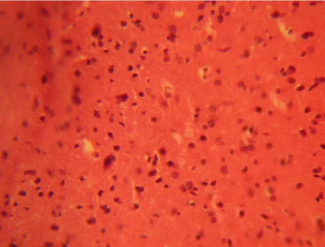 FIGURE 2: Treatment section of the inferior colliculus (3g MSG) (Original magnification x 400)