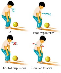 Figura 1.   Síntomas del asma inducida por el  ejercicio (AIE)