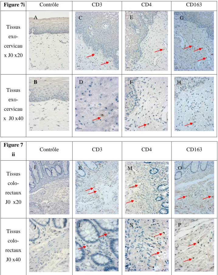 Figure 7i   Contrôle   CD3  CD4  CD163 