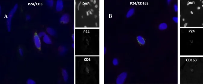 Figure 10: Immunofluorescence pour la détection de cellules infectées par le VIH.   
