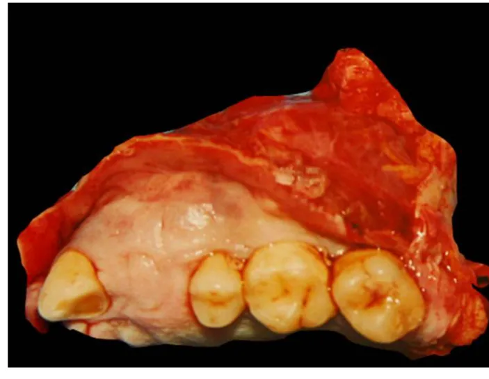 Figura 4 Anatomía Patológica 
