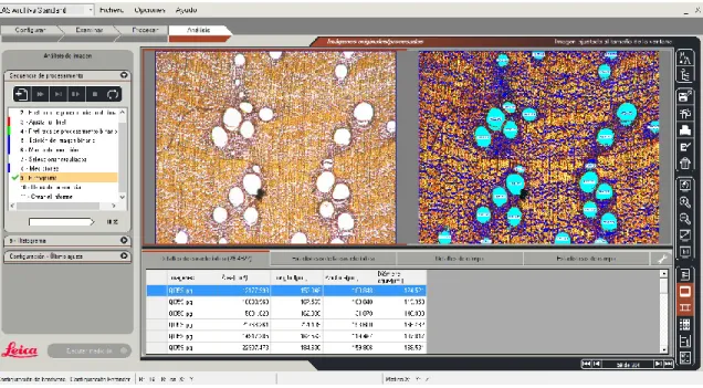 Figura 7. Interface del módulo Análisis del paquete de cómputo LAS 3.8 (Leica Microsystems)