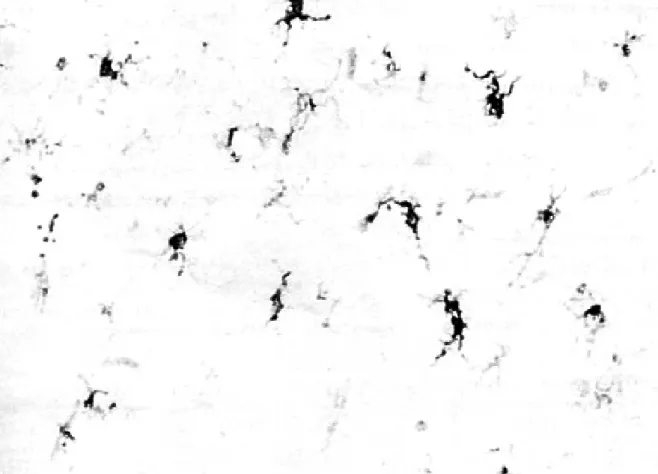 Figure 3. Microglial activation.