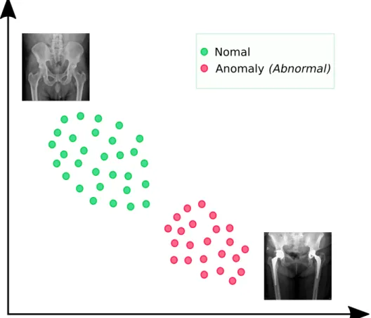 Figure 1.1: Latent space representation. X-ray imaging is encoded into a latent space.