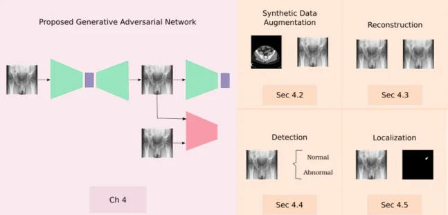 Figure 1.2: General Overview. The main contribution of our work is presented in Chapter 4