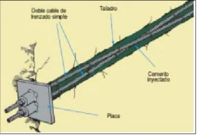 Figura 5. Perno, sistema activo. 
