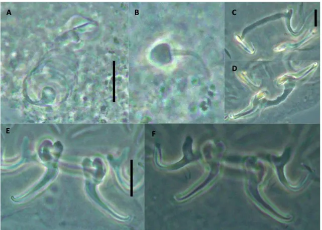 Figure  4.  Gussevia  cichlassomatis  collected  from  Aequidens  tetramerus. 