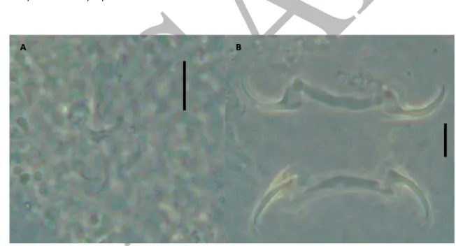 Figure 7. Sciadicleithrum sp. 1. Copulatory complex (A), Haptor (B). Scale Bar: A = 560 
