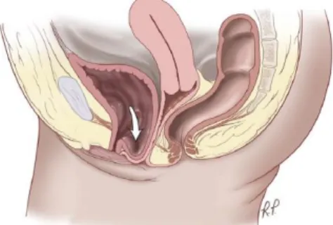 Figura 10: Protrusió total (8)