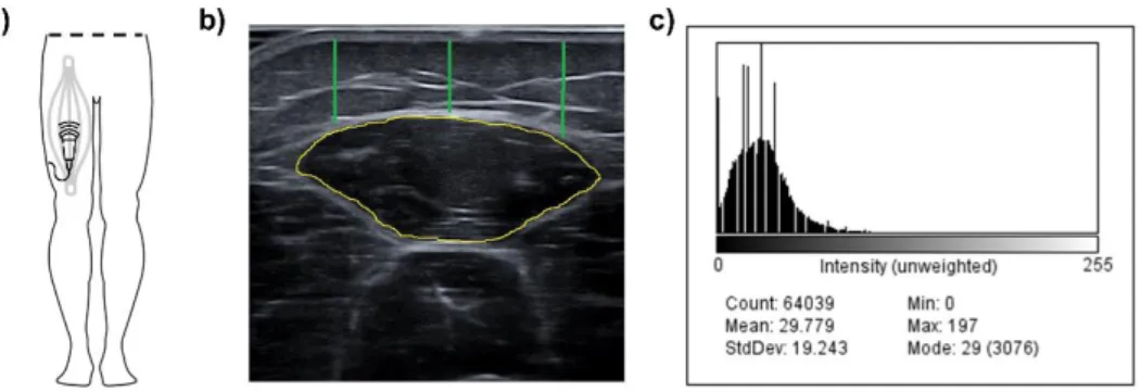 Figure 4.1. Illustrative representation of the experimental model. Figure 1a represents  the area where the ultrasound is performed (rectus femoris of quadriceps)
