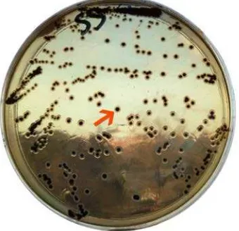 Figura 3. Morfología típica de colonias sospechosas de Salmonella-ShigellaSalmonella spp en agar 