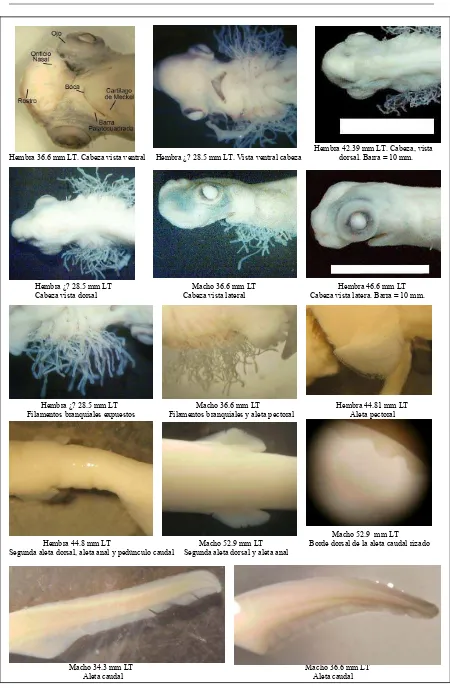 Figura 17. Estructuras en diferentes embriones Fase I, desde diferentes vistas. 