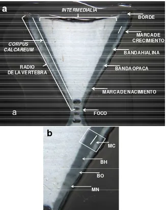 Figura 3. a) Imagen de una vértebra de tiburón martillo que muestra las diferentes partes indicadas en el texto, b) acercamiento del calcareumcorpus : MN (marca de nacimiento), BO (banda opaca), BH (banda hialina) y MC (marca de crecimiento)
