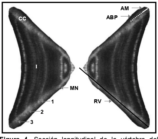 Figura 4. Sección longitudinal de la vértebra del cazón pardo, M. henlei. RV- Radio de la vértebra, MN- Marca de nacimiento, 1, 2, 3 - Anillos de crecimiento y edad, CC- corpus calcareum