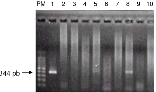 Figura 1.Identificación de ADN de BoHV-1 mediante PCR en muestras de la primera inmunodepresión del toro Limousin