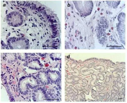 Figura 5. Fotografías de muestras de biopsias endometriales de yeguas pertenecientes al grupo control en el día 6 (a) y día 15 (c) y de yeguas infundidas en el día 6 (b) y 15 (d)ovulación