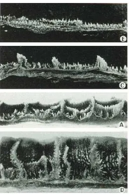 Figura 7. Fotos de la mucosa reticular con ejemplos de diferencias en la altura de