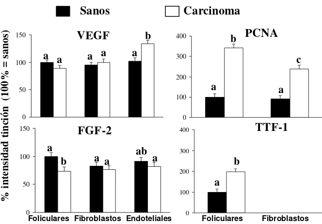 Figura 3. Intensidad de tinción (expresado en porcentaje, 100% = intensidad de tinción de las células foliculares del grupo control) de VEGF, FGF-2, PCNA y TTF-1 en células foliculares, fibroblastos y células endoteliales de glándulas sanas y carcinomatosa