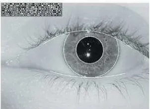 Figura 2.7: Imagen de vasculatura retinal