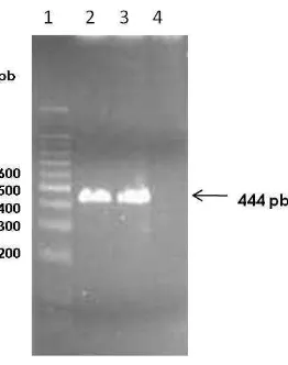Figura 5. Productos de amplficación. Gel de agarosa al 1.5% en el que se muestran marcador de 100pb (carril 1), producto de amplificación a partir de ADN de M. tuberculosis (carril 2), producto de amplificación a partir de ADN plasmídico pUC19-Rv2031c (carril 3), control negativo (carril 4). Los productos de amplificación corresponden a 444 pb. 