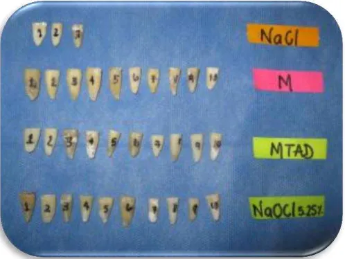Fig 1. Grupos de órganos dentarios 