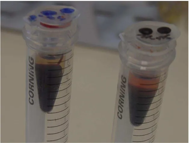 Fig. 7 Centrífuga que se utilizó para separar el suero del plasma. 