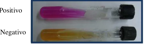 Figura 5. Crecimiento de Cryptococcus spp. en agar urea de Christensen 