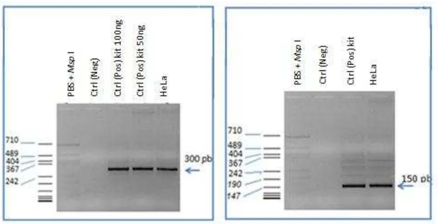 Figura 8. Amplificación de los genes de referencia GAPDH y βamplificación a partir de ADN control y por último la amplificación a partir de DNA de células HeLa (las cuales -actina para normalizar resultados