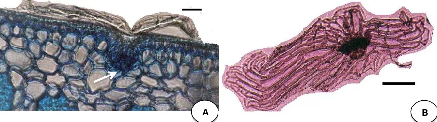 Figura 7. Vista frontal de la lámina foliar de hoja de P. eryngioides, (A) detalle de la base de la escama peltada compuesto por más de dos células; (B) detalle de la escama pelta (tricoma) con sus alas alargadas