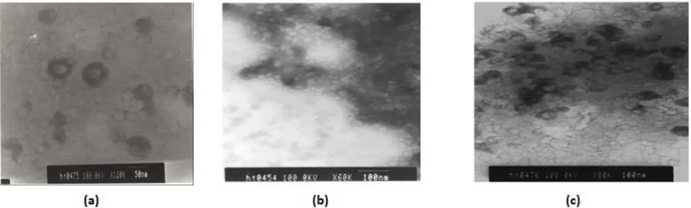 Figura 4. Fotografía obtenidos en el TEM de polímeros núcleo/coraza PSt/PAB =40/60 obtenidos con:  (a) ausencia de  sales (SS); (b) presencia de sal inorgánica (SI) y (c) sal orgánica (SO)
