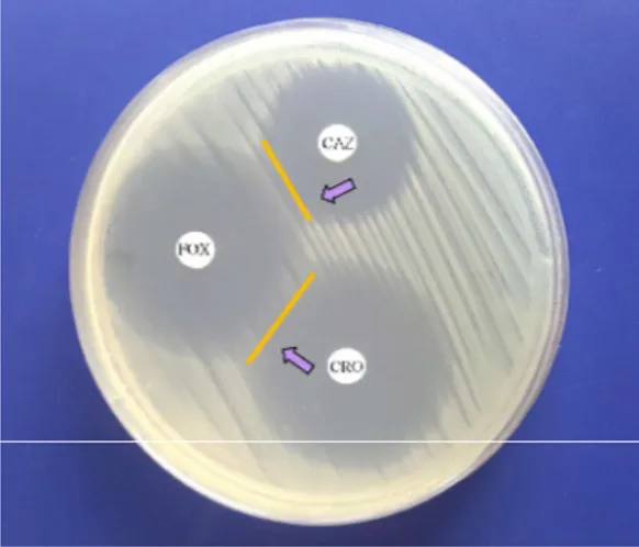 Figura 1. Método de detección de AmpC de tipo inducible según el método de 