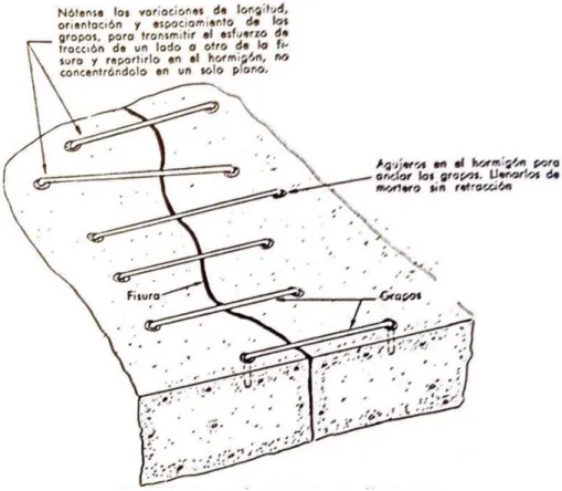Figura 10 Reparación de una fisura mediante grapas. (Casas, 1973)